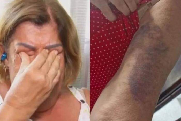 BRASIL: Professora de 65 anos, espancada ao cobrar dever de casa está traumatizada: “Medo”